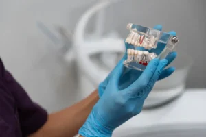 dentista in albania tirana